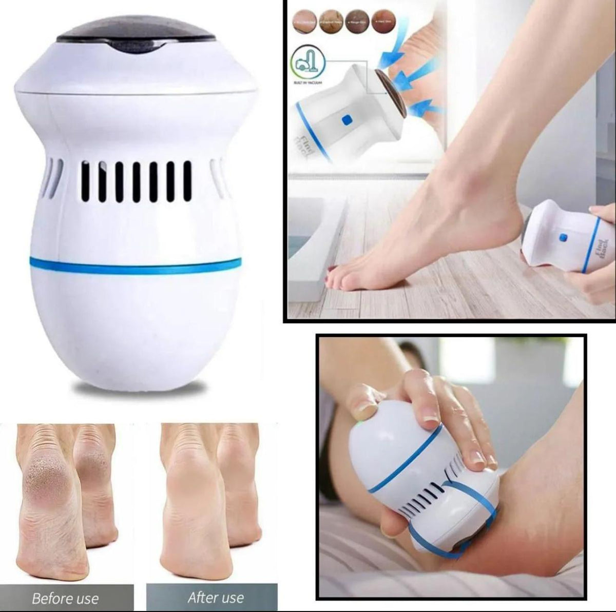 Cellus Foot Care Pedicure Tools Cellus Remover